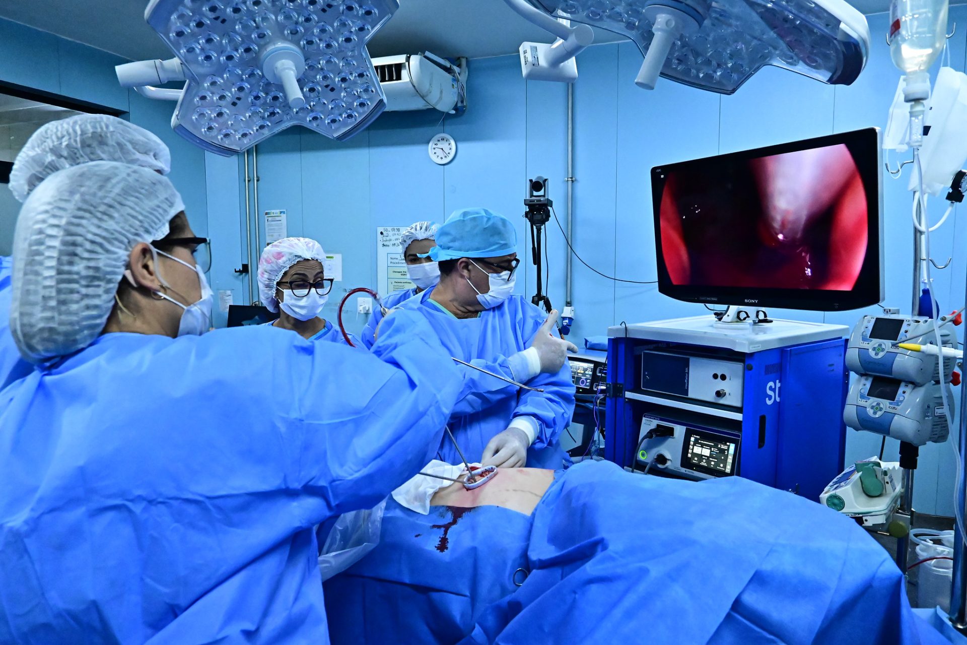 Capa da notícia: Hospital de Base recebe etapa final de curso internacional de cirurgia torácica com tecnologia 3D