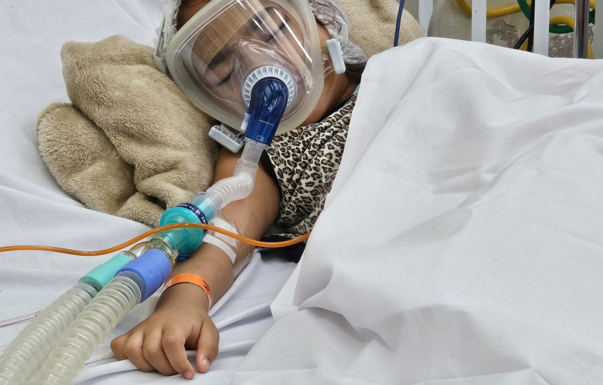 Capa da notícia: Bronquiolite é a principal causa de internação por infecção respiratória em menores de 1 ano